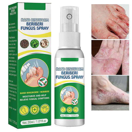 Spray antifúngico para pies de atleta Oferta 2x1